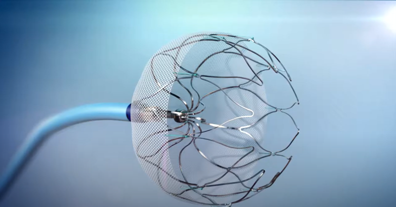 WATCHMAN™ Implant Animation Thumbnail